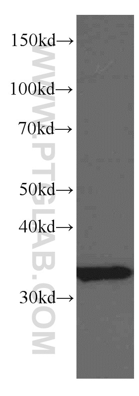 Western Blot (WB) analysis of mouse brain tissue using TST Monoclonal antibody (66018-1-Ig)