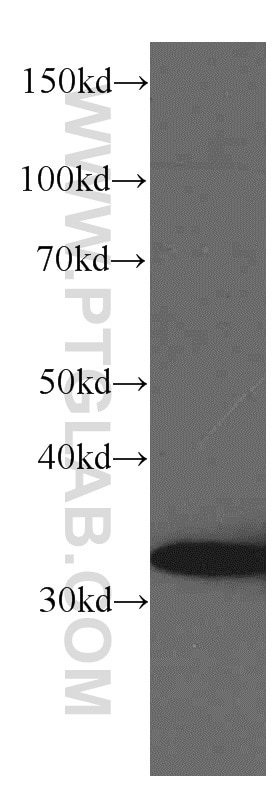 Western Blot (WB) analysis of rat brain tissue using TST Monoclonal antibody (66018-1-Ig)