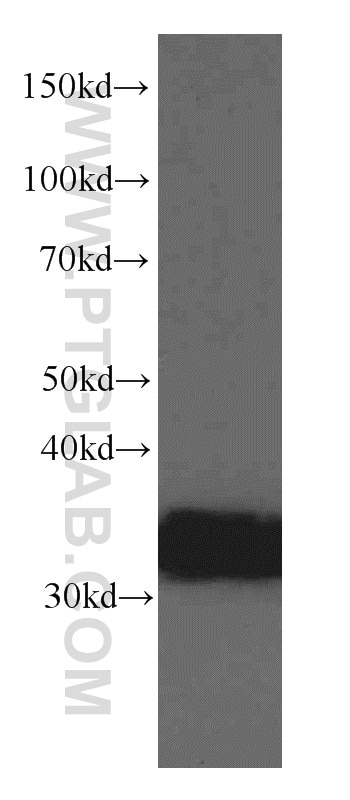 Western Blot (WB) analysis of mouse liver tissue using TST Monoclonal antibody (66018-1-Ig)