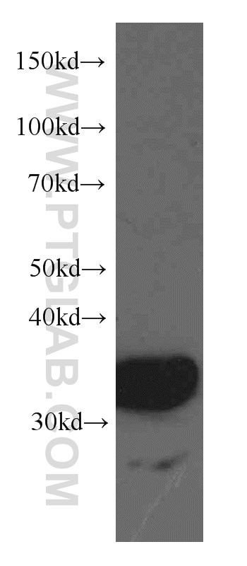 Western Blot (WB) analysis of rat liver tissue using TST Monoclonal antibody (66018-1-Ig)