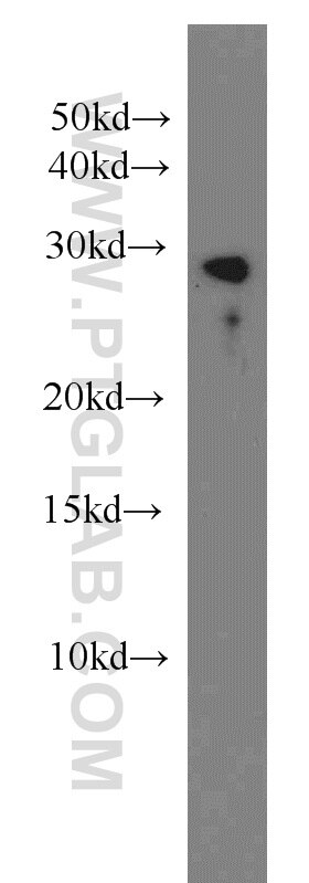 Western Blot (WB) analysis of human brain tissue using TST Monoclonal antibody (66018-1-Ig)