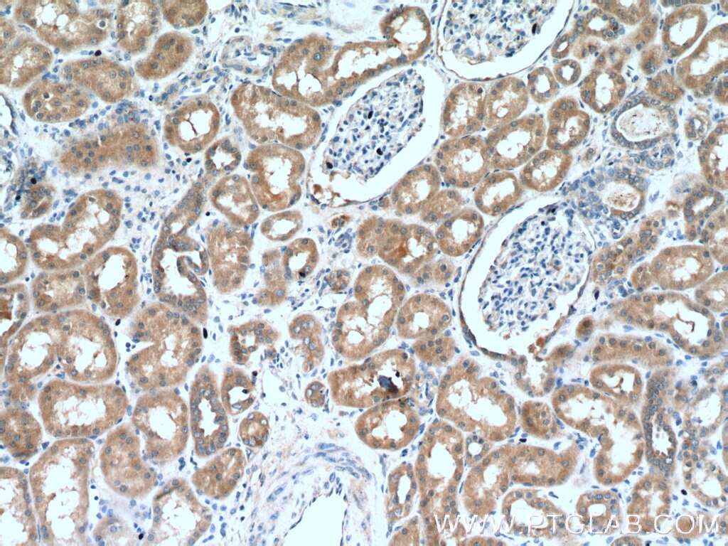 Immunohistochemistry (IHC) staining of human kidney tissue using TSTA3 Polyclonal antibody (15335-1-AP)