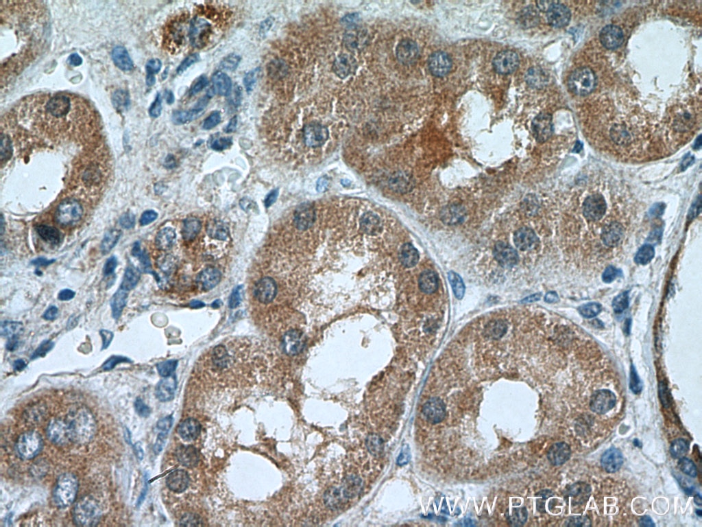 Immunohistochemistry (IHC) staining of human kidney tissue using TSTA3 Polyclonal antibody (15335-1-AP)