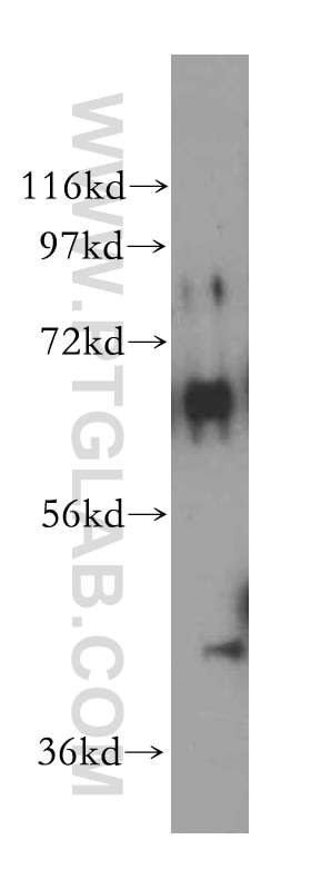 Western Blot (WB) analysis of human brain tissue using TSTA3 Polyclonal antibody (15335-1-AP)