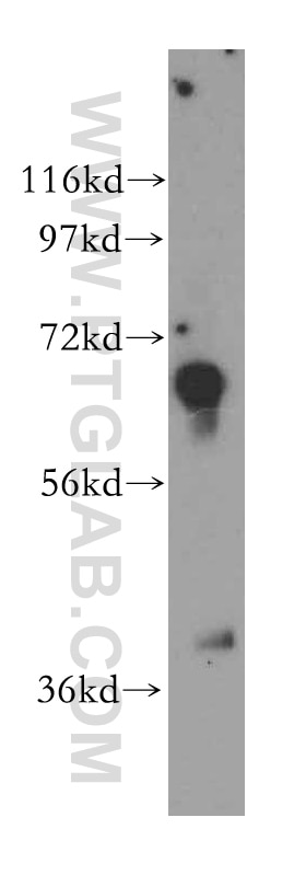 Western Blot (WB) analysis of human kidney tissue using TSTA3 Polyclonal antibody (15335-1-AP)