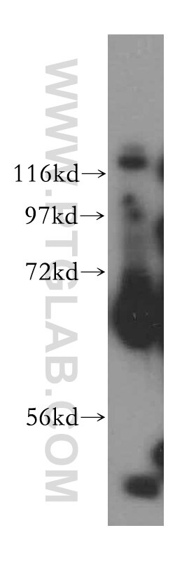 Western Blot (WB) analysis of HeLa cells using TSTA3 Polyclonal antibody (15335-1-AP)
