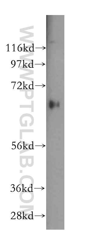 Western Blot (WB) analysis of HEK-293 cells using TSTA3 Polyclonal antibody (15335-1-AP)