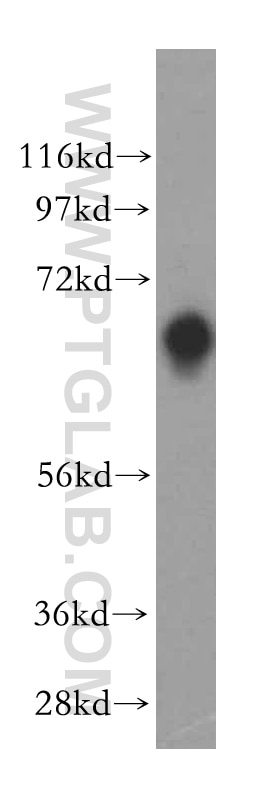 Western Blot (WB) analysis of human colon tissue using TSTA3 Polyclonal antibody (15335-1-AP)