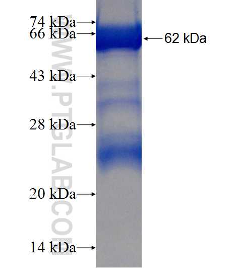 TSTA3 fusion protein Ag7450 SDS-PAGE