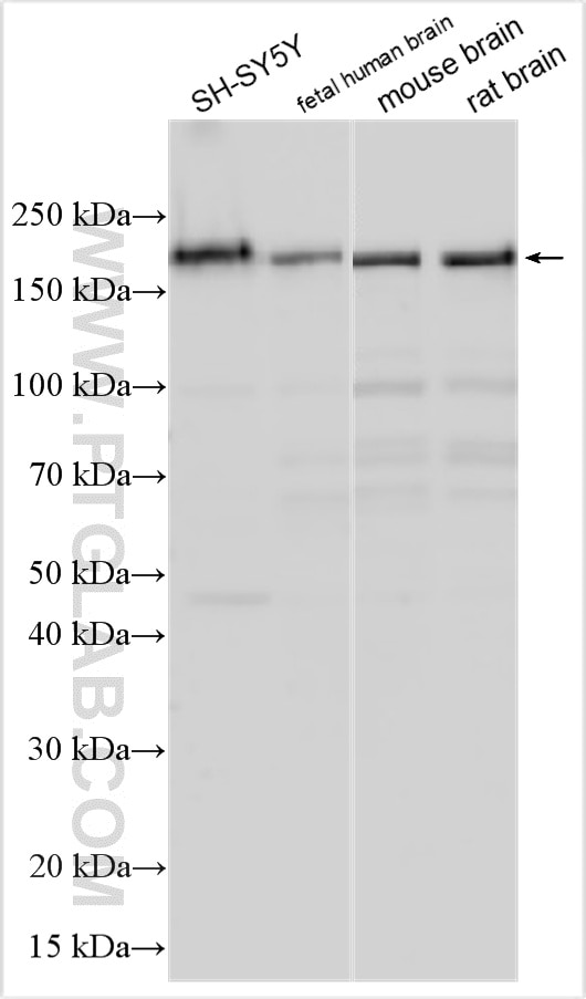 Western Blot (WB) analysis of various lysates using TTBK1 Polyclonal antibody (32938-1-AP)