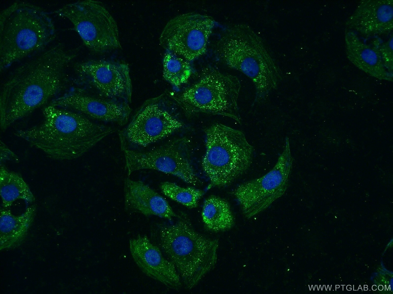 Immunofluorescence (IF) / fluorescent staining of SH-SY5Y cells using TTBK2 Polyclonal antibody (15072-1-AP)