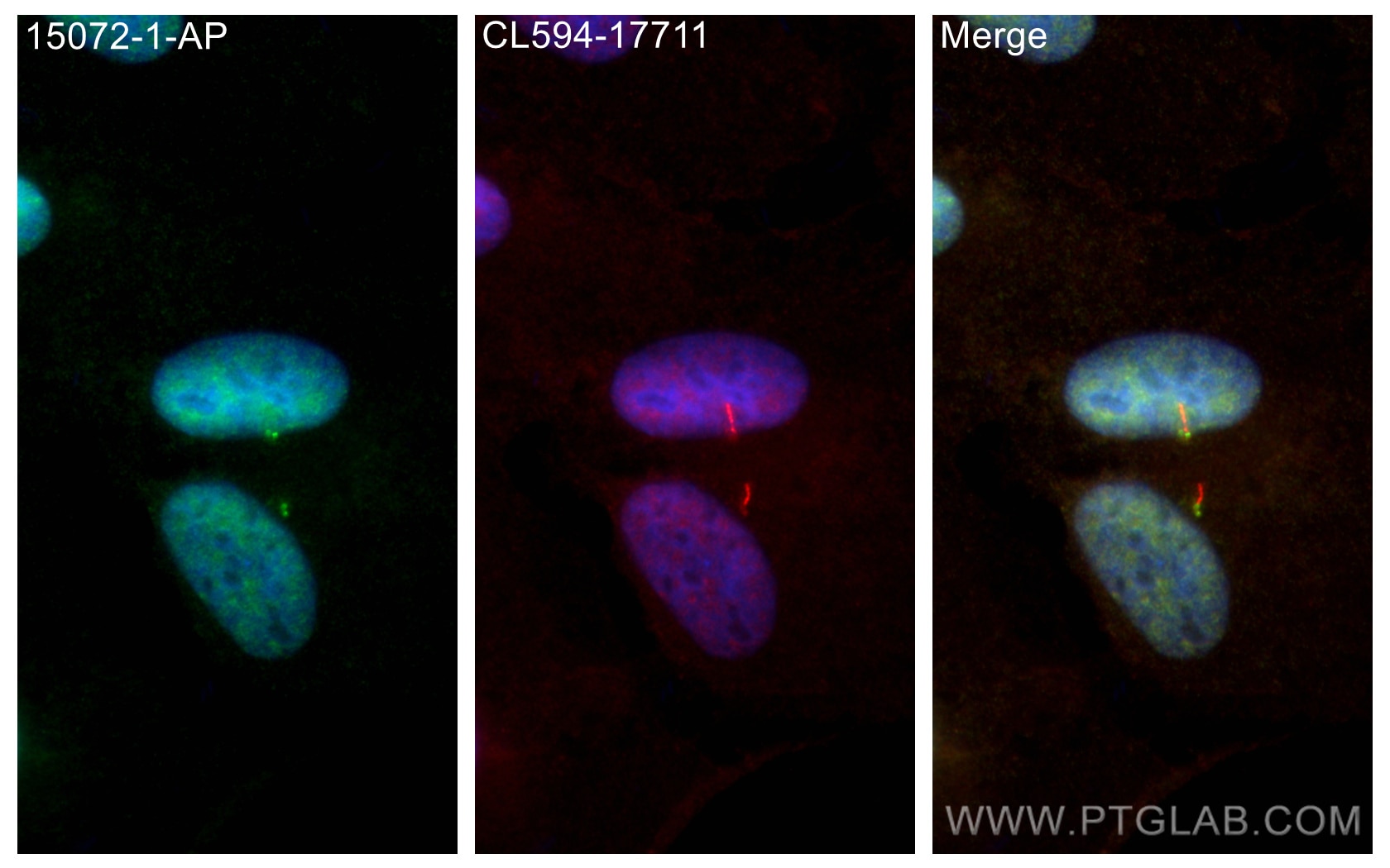 Immunofluorescence (IF) / fluorescent staining of hTERT-RPE1 cells using TTBK2 Polyclonal antibody (15072-1-AP)