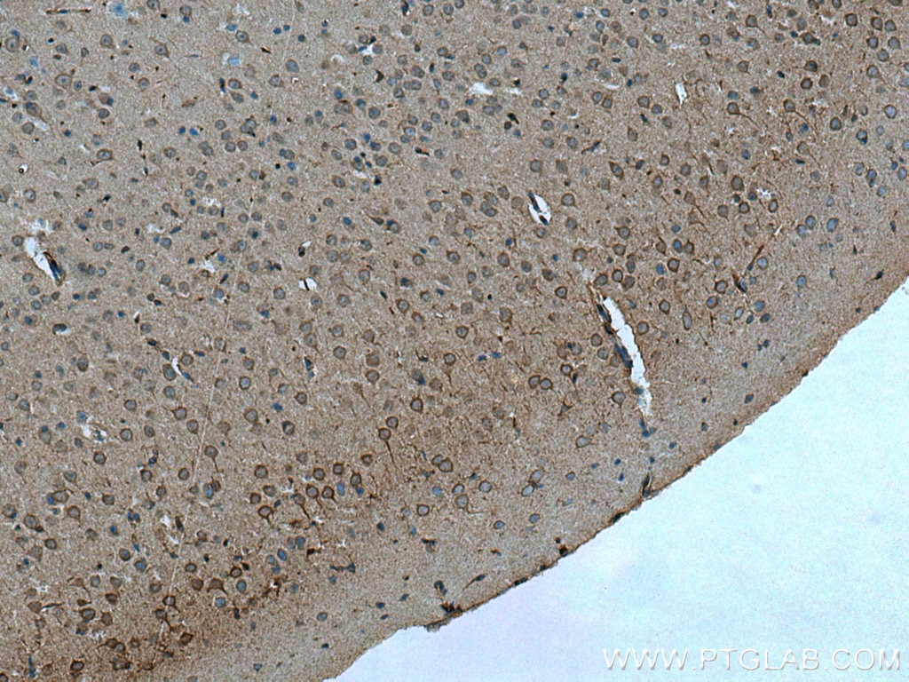 Immunohistochemistry (IHC) staining of mouse brain tissue using TTBK2 Polyclonal antibody (15072-1-AP)