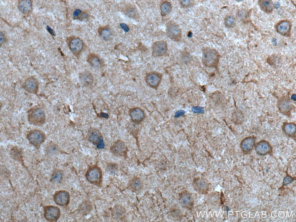 Immunohistochemistry (IHC) staining of mouse brain tissue using TTBK2 Polyclonal antibody (15072-1-AP)