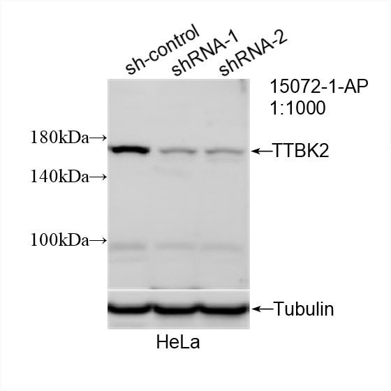 Western Blot (WB) analysis of HeLa cells using TTBK2 Polyclonal antibody (15072-1-AP)