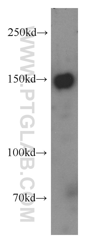 Western Blot (WB) analysis of PC-3 cells using TTBK2 Polyclonal antibody (15072-1-AP)
