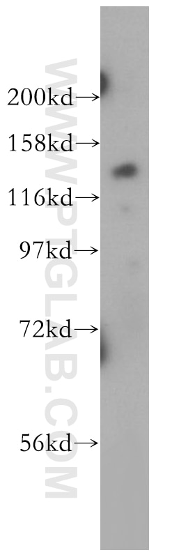 Western Blot (WB) analysis of SH-SY5Y cells using TTBK2 Polyclonal antibody (15072-1-AP)
