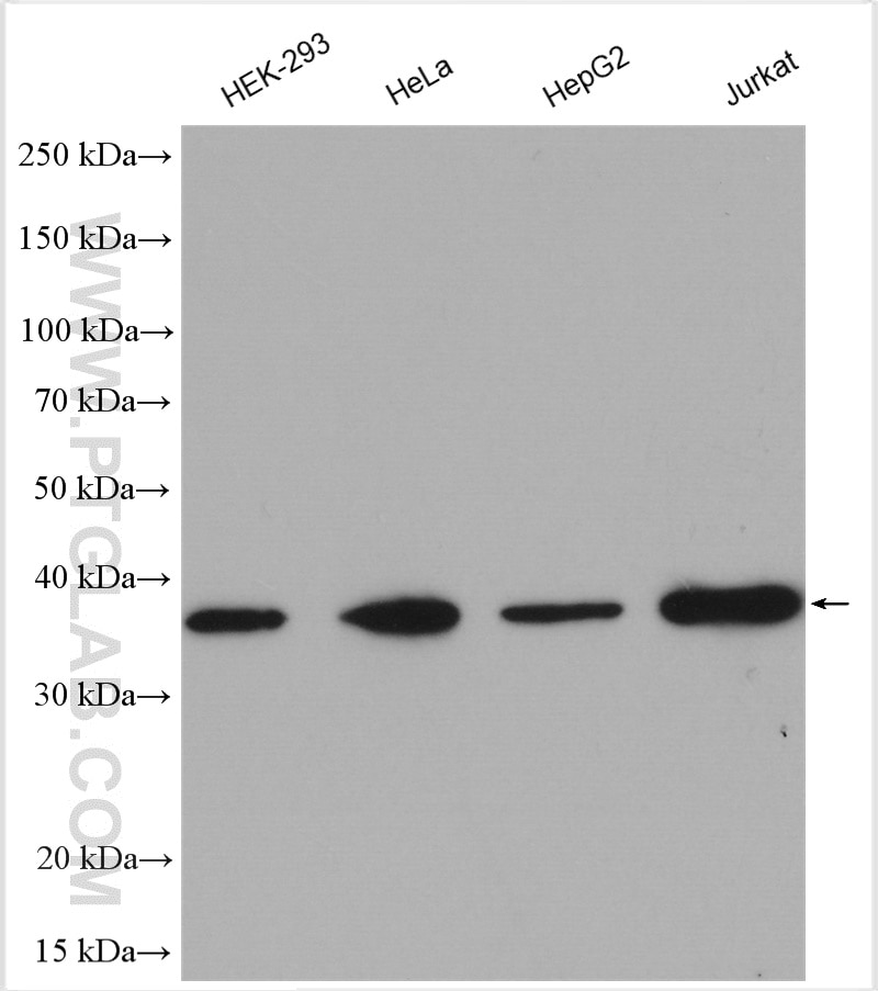Western Blot (WB) analysis of various lysates using TTC1 Polyclonal antibody (11676-1-AP)