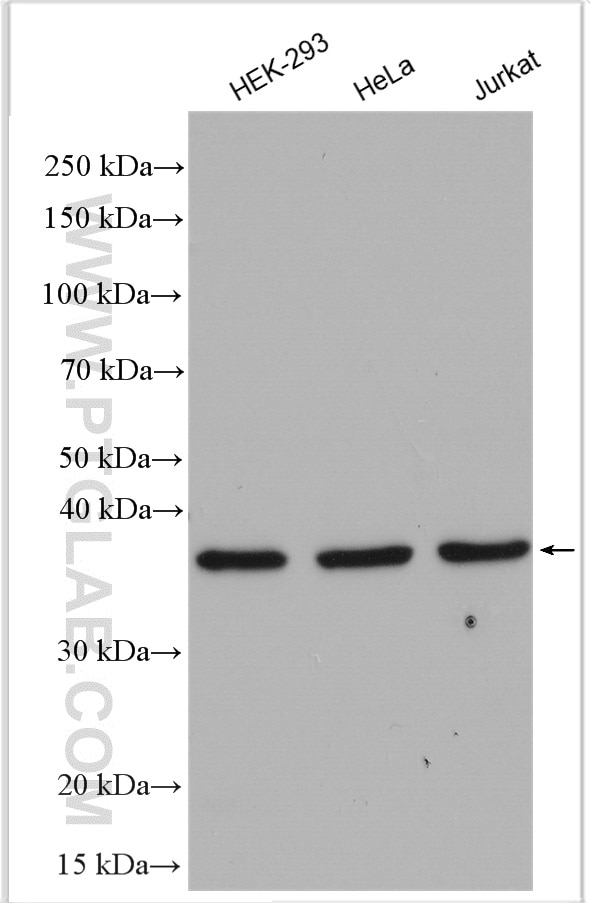 Western Blot (WB) analysis of various lysates using TTC1 Polyclonal antibody (11676-1-AP)