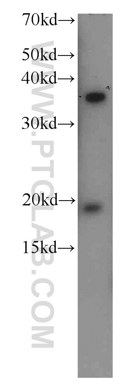 Western Blot (WB) analysis of HepG2 cells using TTC1 Polyclonal antibody (11676-1-AP)