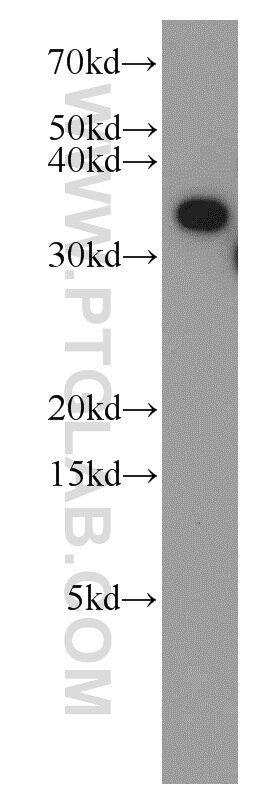 Western Blot (WB) analysis of HEK-293 cells using TTC1 Polyclonal antibody (11676-1-AP)