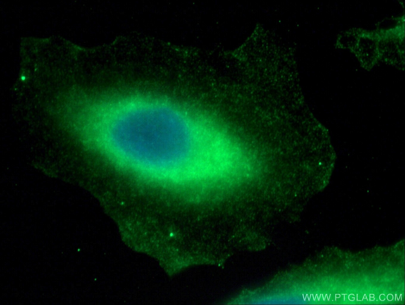 Immunofluorescence (IF) / fluorescent staining of A549 cells using TTC12 Polyclonal antibody (28216-1-AP)
