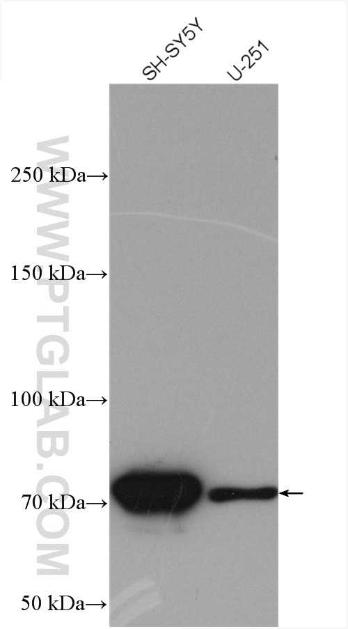 Western Blot (WB) analysis of various lysates using TTC12 Polyclonal antibody (28216-1-AP)