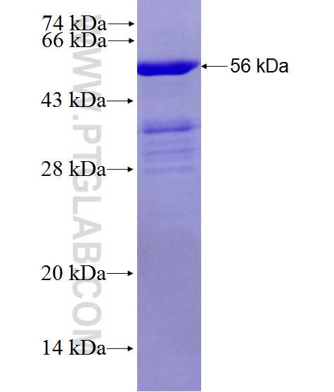 TTC12 fusion protein Ag28199 SDS-PAGE