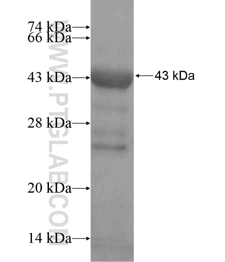 TTC15 fusion protein Ag18332 SDS-PAGE
