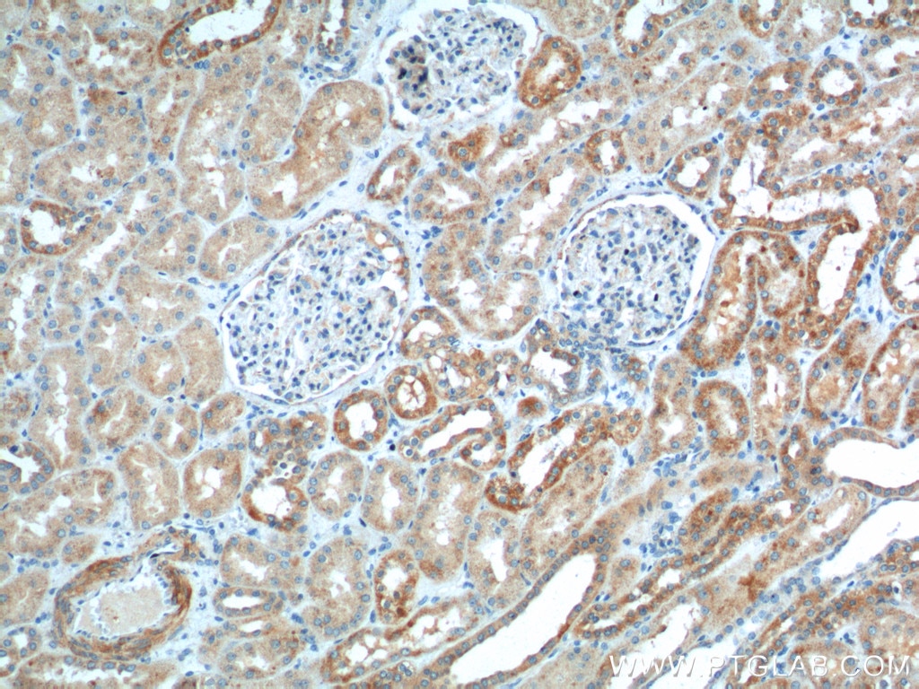 Immunohistochemistry (IHC) staining of human kidney tissue using TTC17 Polyclonal antibody (25660-1-AP)