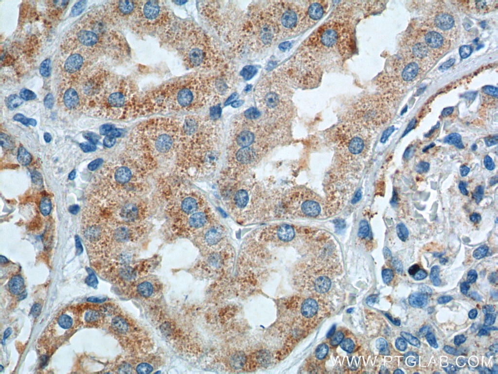 Immunohistochemistry (IHC) staining of human kidney tissue using TTC17 Polyclonal antibody (25660-1-AP)