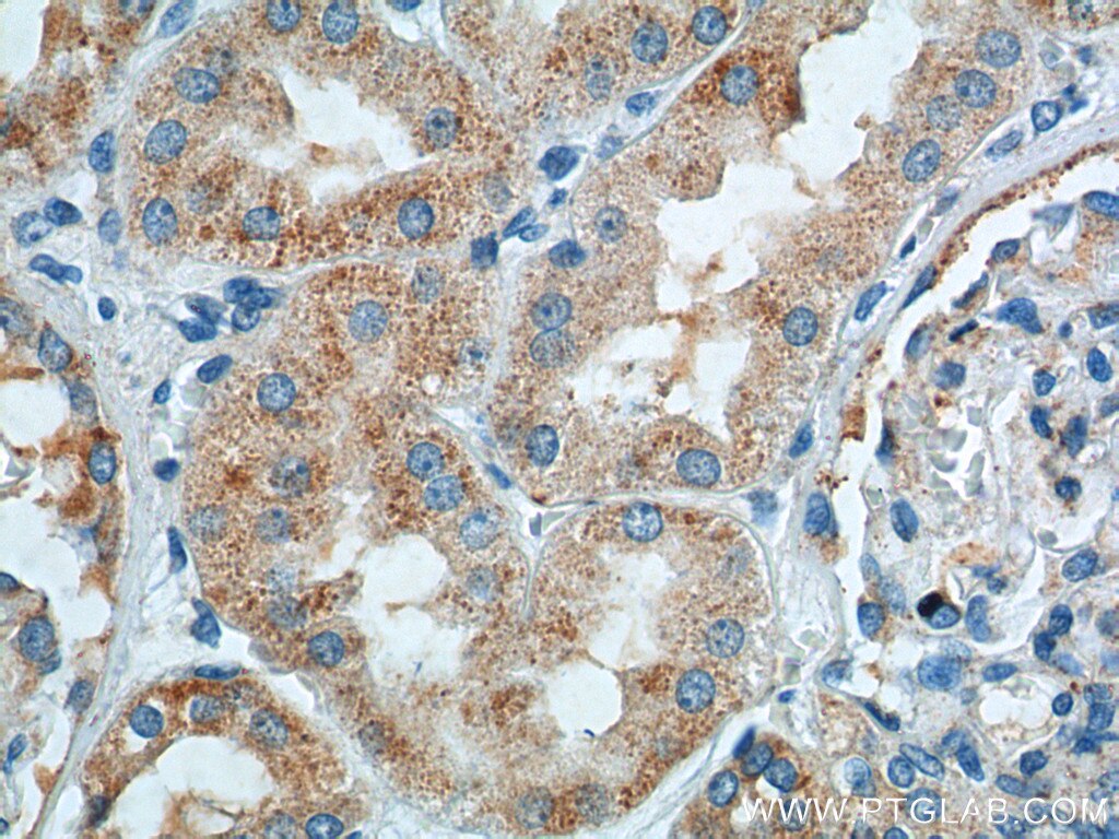 Immunohistochemistry (IHC) staining of human kidney tissue using TTC17 Polyclonal antibody (25660-1-AP)