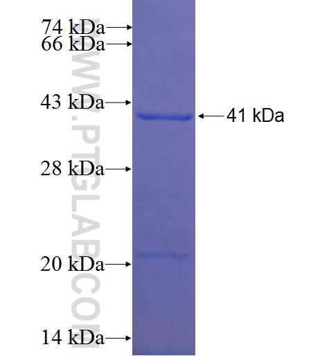 TTC17 fusion protein Ag22572 SDS-PAGE