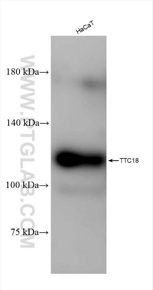 Western Blot (WB) analysis of various lysates using TTC18 Recombinant antibody (84133-5-RR)