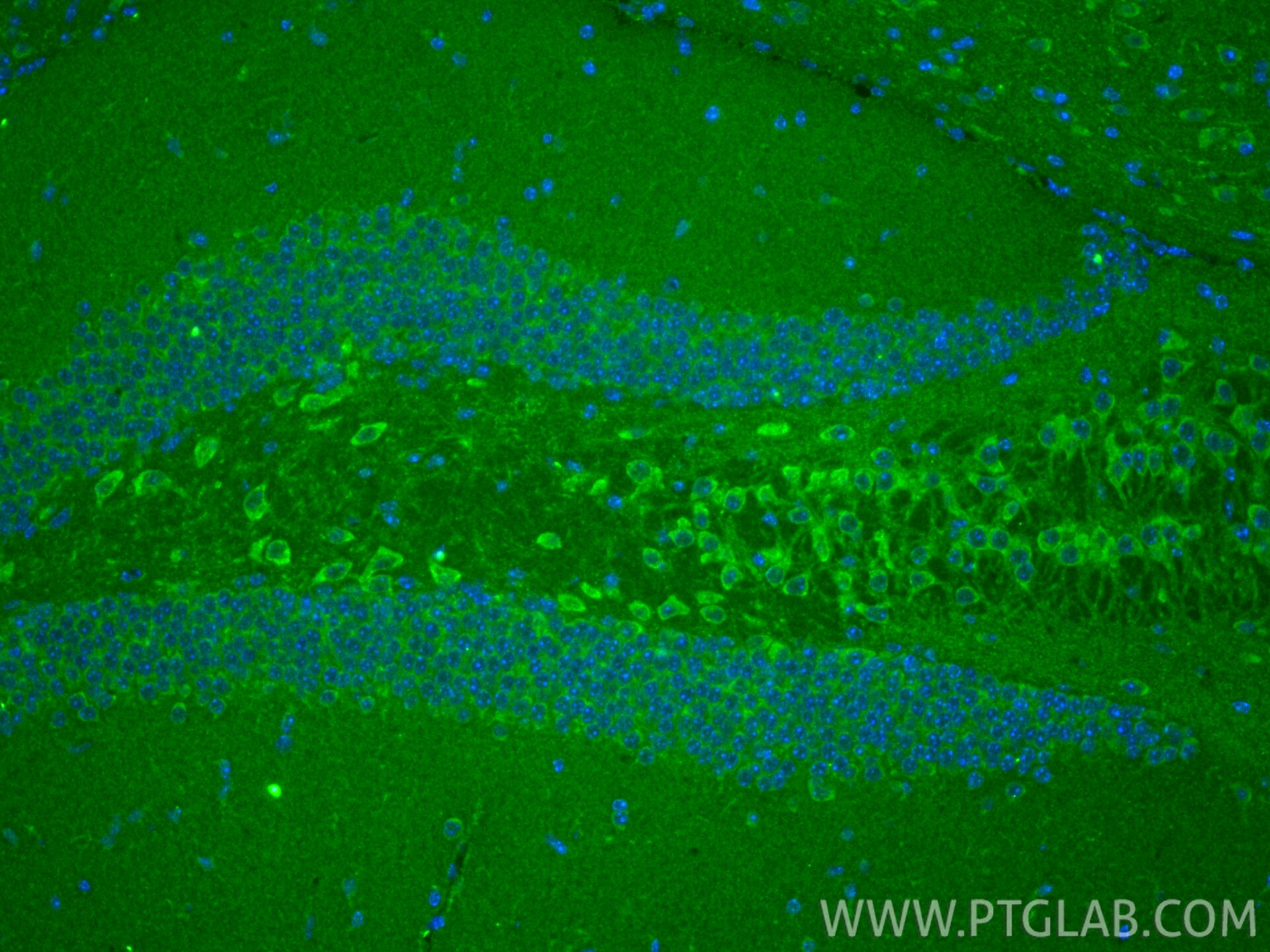 IF Staining of mouse brain using 20875-1-AP Immunofluorescence (IF) / fluorescent staining of mouse brain tissue using TTC19 Polyclonal antibody (20875-1-AP)