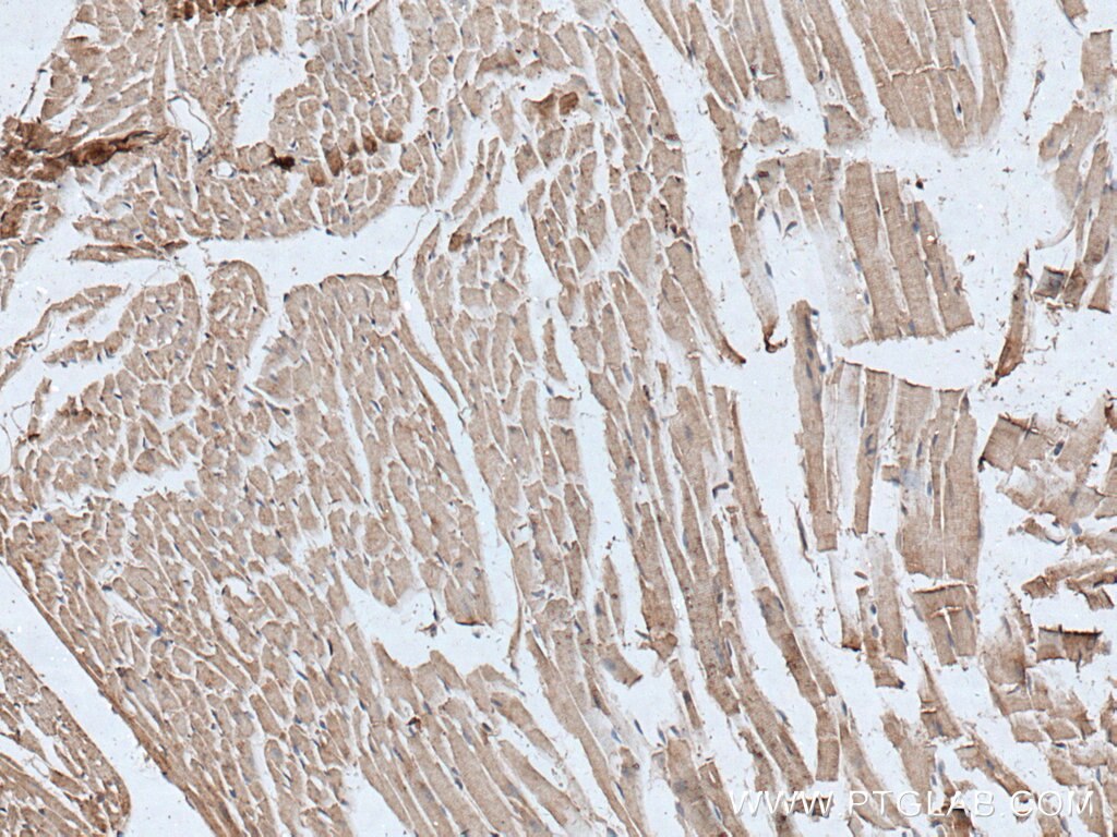 Immunohistochemistry (IHC) staining of mouse heart tissue using TTC19 Polyclonal antibody (20875-1-AP)