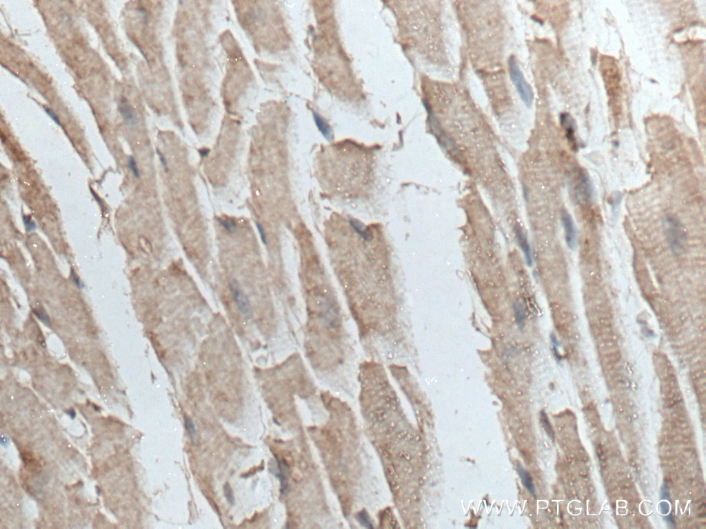 Immunohistochemistry (IHC) staining of mouse heart tissue using TTC19 Polyclonal antibody (20875-1-AP)