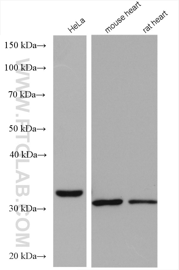 Western Blot (WB) analysis of various lysates using TTC19 Polyclonal antibody (20875-1-AP)