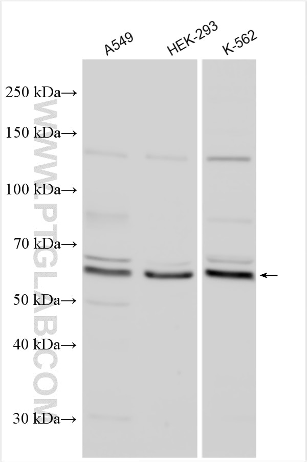 Western Blot (WB) analysis of various lysates using TTC21B Polyclonal antibody (30112-1-AP)