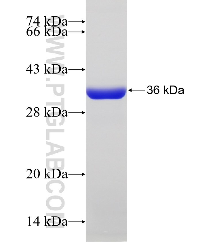TTC21B fusion protein Ag32456 SDS-PAGE TTC21B fusion protein Ag32456 SDS-PAGE