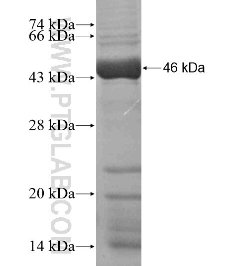 TTC25 fusion protein Ag18604 SDS-PAGE