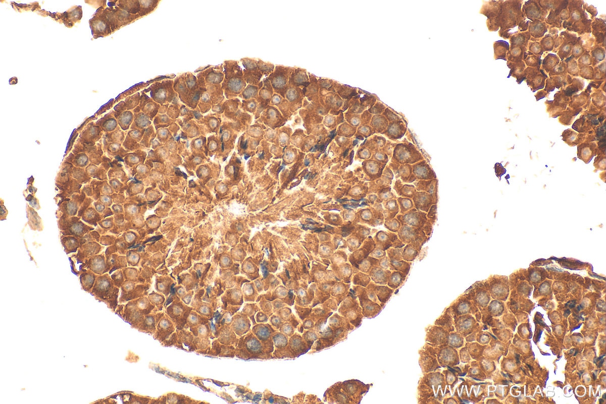 Immunohistochemistry (IHC) staining of mouse testis tissue using TTC26 Polyclonal antibody (25083-1-AP)