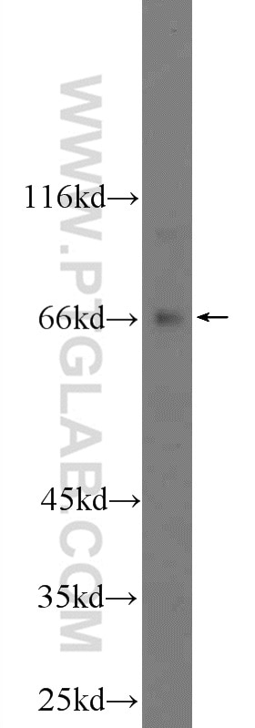 Western Blot (WB) analysis of HEK-293 cells using TTC26 Polyclonal antibody (25083-1-AP)