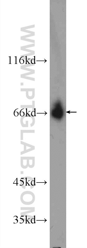 Western Blot (WB) analysis of NIH/3T3 cells using TTC26 Polyclonal antibody (25083-1-AP)