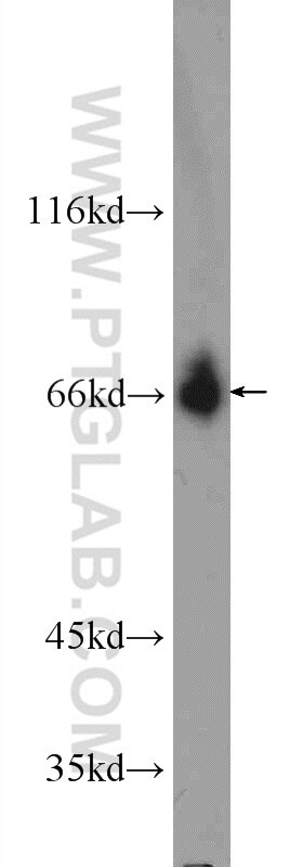 WB analysis of NIH/3T3 using 25083-1-AP