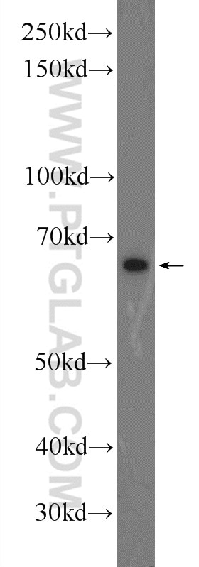 Western Blot (WB) analysis of mouse testis tissue using TTC26 Polyclonal antibody (25083-1-AP)