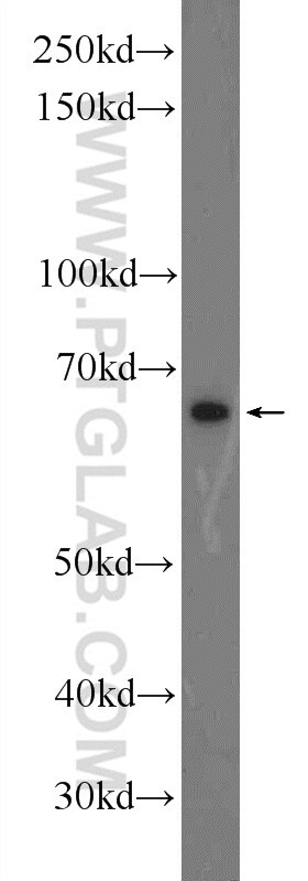 Western Blot (WB) analysis of mouse testis tissue using TTC26 Polyclonal antibody (25083-1-AP)