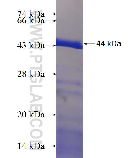 TTC26 fusion protein Ag18983 SDS-PAGE