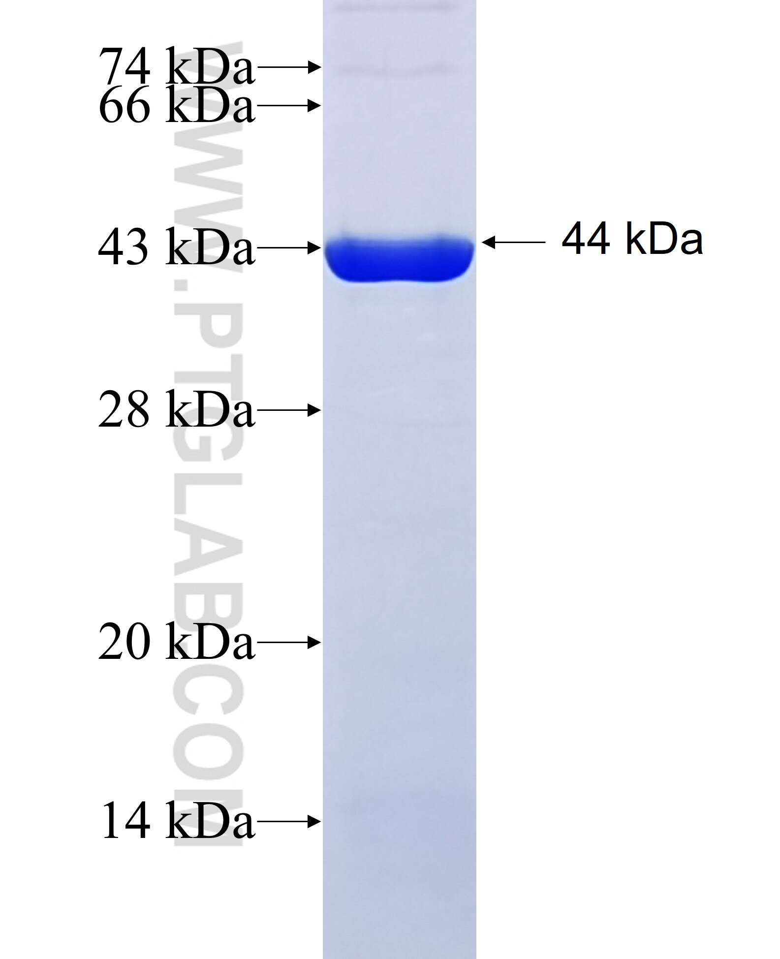 TTC26 fusion protein Ag18983 SDS-PAGE