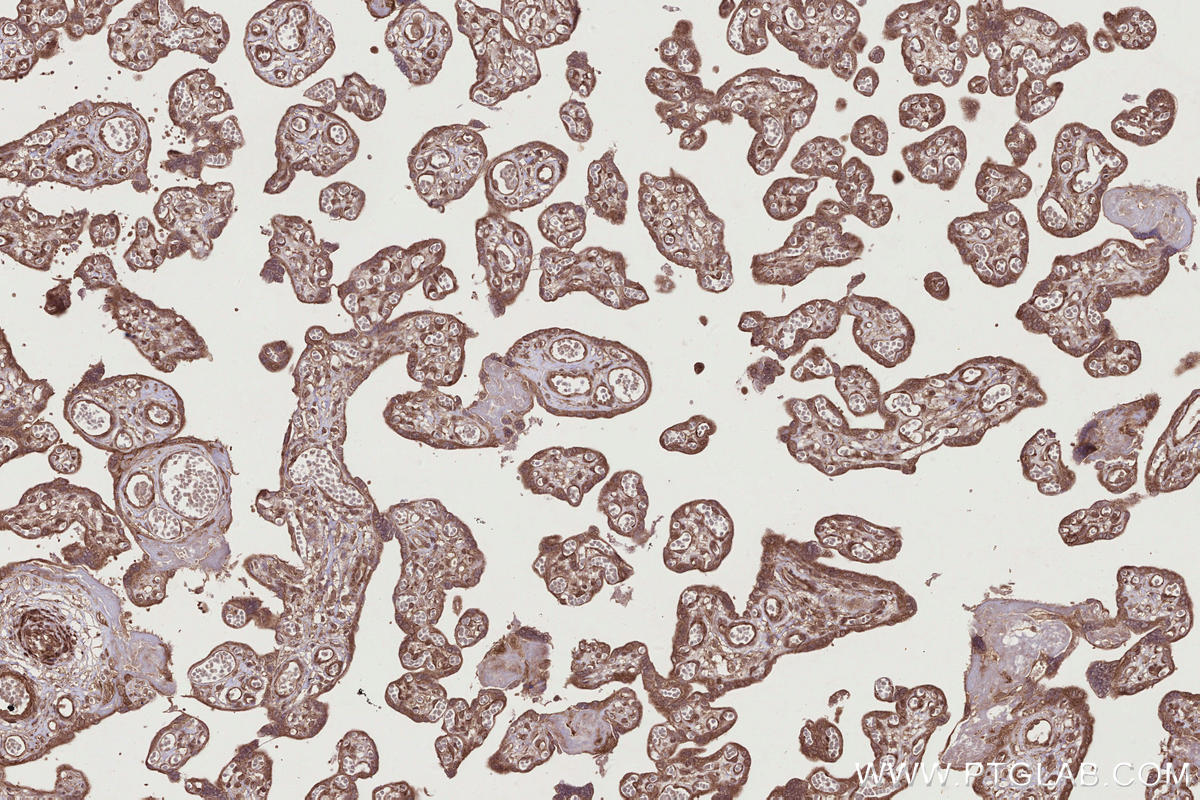 IHC staining of human placenta using 25701-1-AP Immunohistochemistry (IHC) staining of human placenta tissue using TTC28 Polyclonal antibody (25701-1-AP)